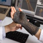 sera-o-fim-do-gesso?-ortopedia-entra-na-era-3d-para-personalizacao